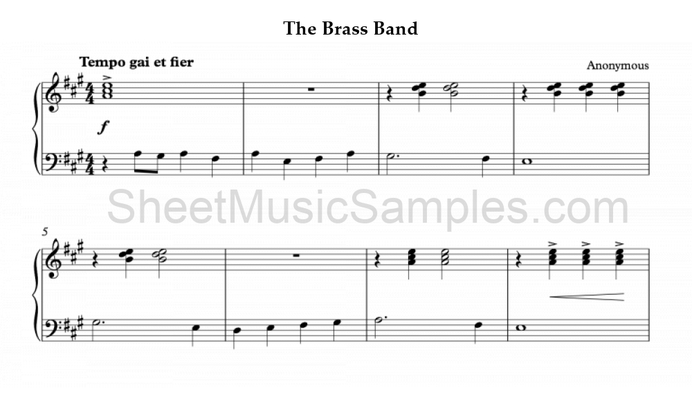 The Brass Band