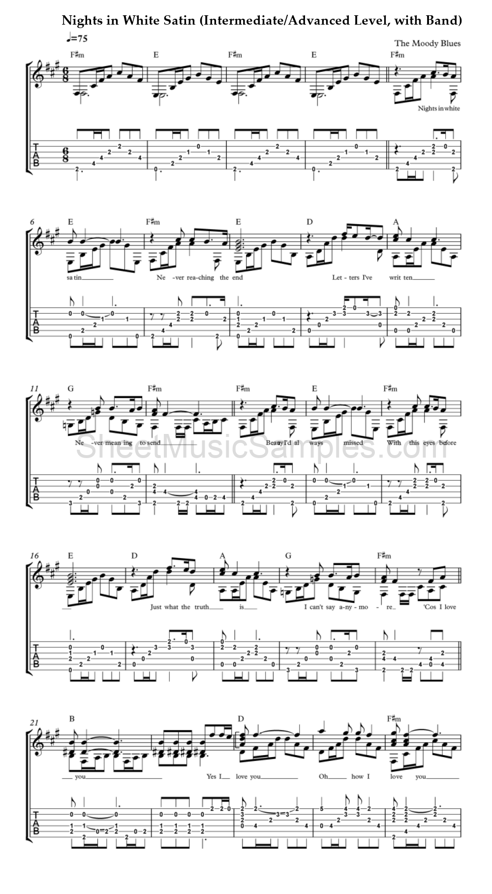 Nights in White Satin (Intermediate/Advanced Level, with Band)