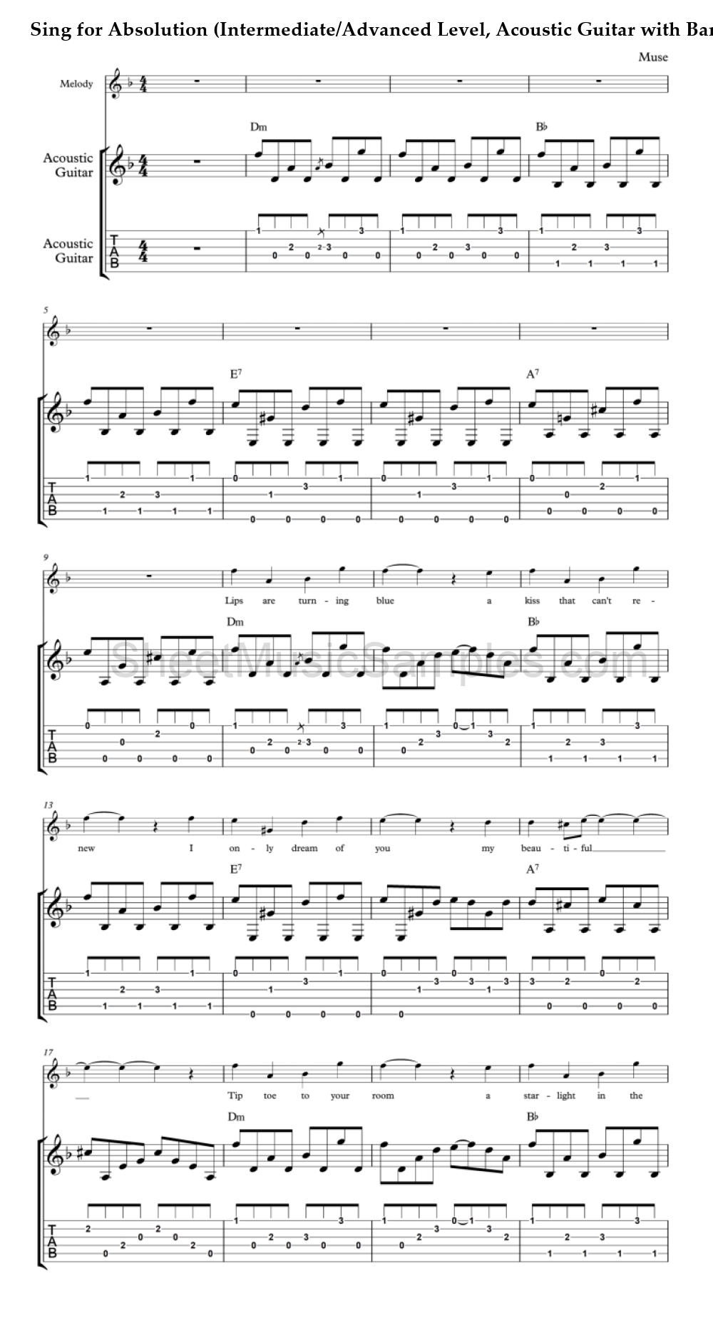 Sing for Absolution (Intermediate/Advanced Level, Acoustic Guitar with Band)