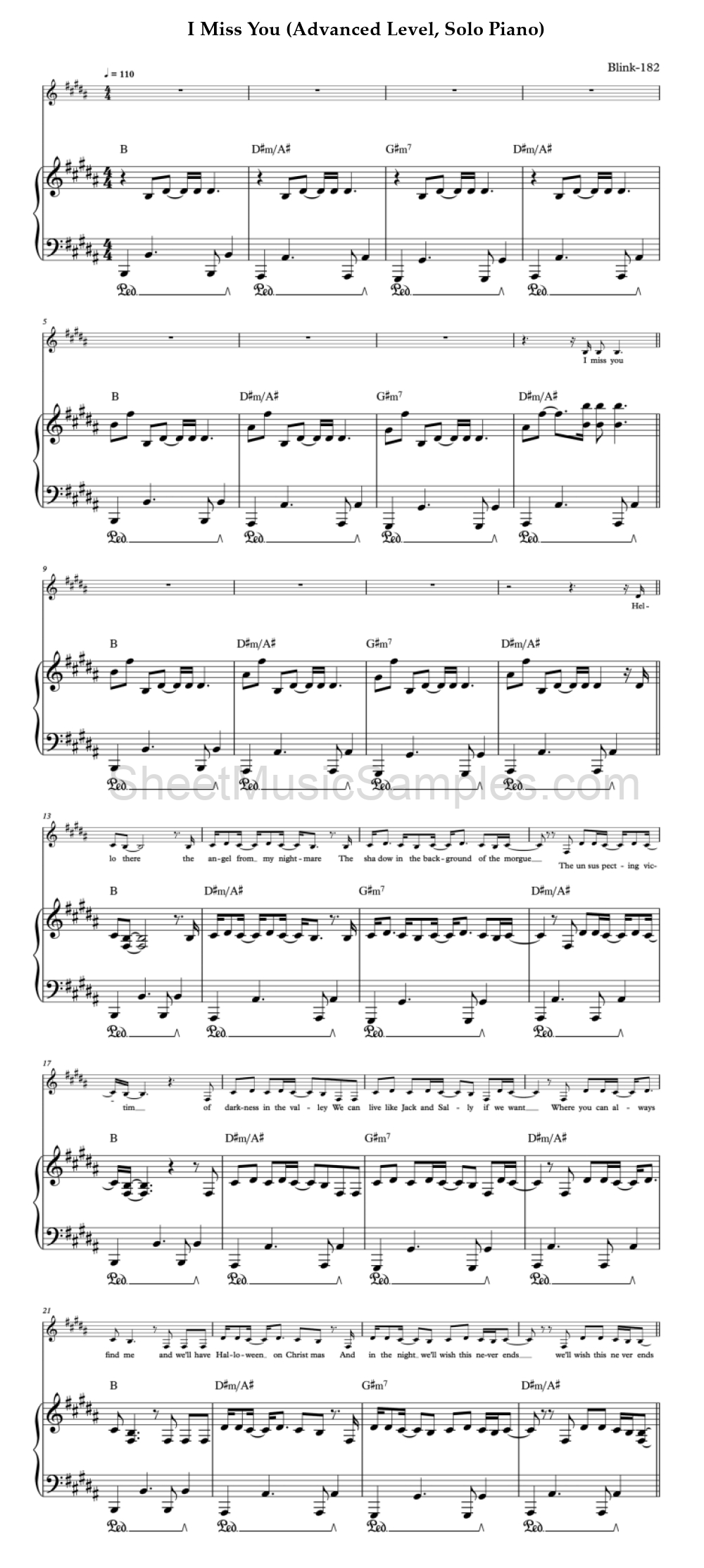 I Miss You (Advanced Level, Solo Piano)