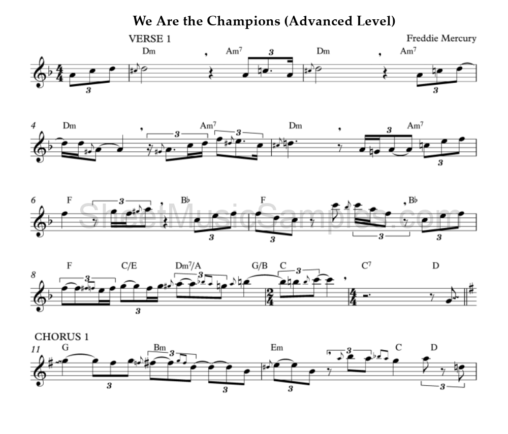 We Are the Champions (Advanced Level)