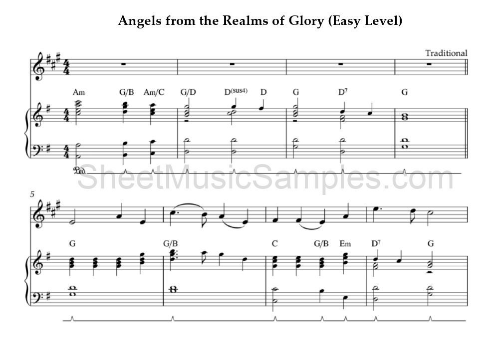 Angels from the Realms of Glory (Easy Level)