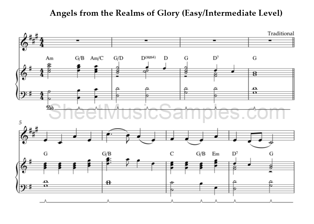 Angels from the Realms of Glory (Easy/Intermediate Level)