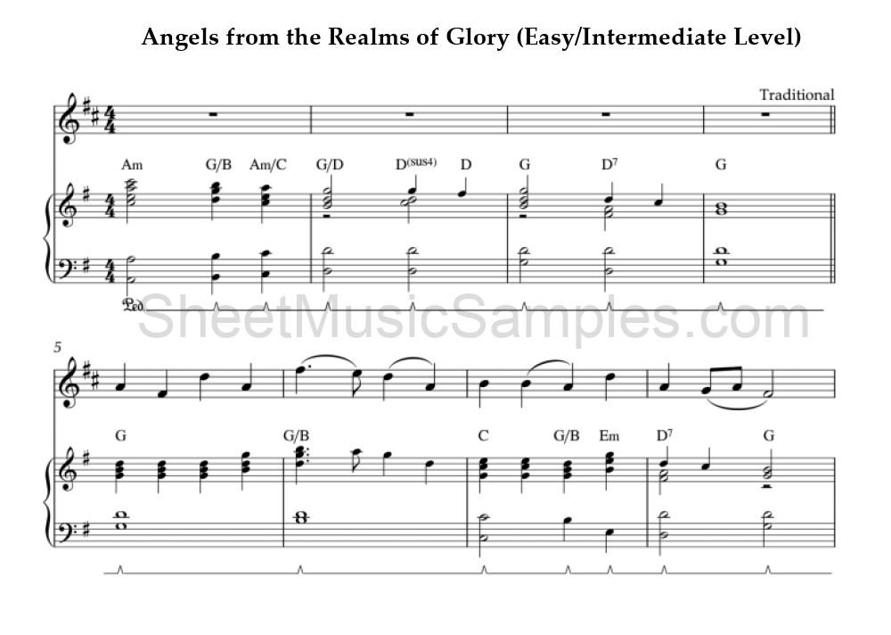 Angels from the Realms of Glory (Easy/Intermediate Level)