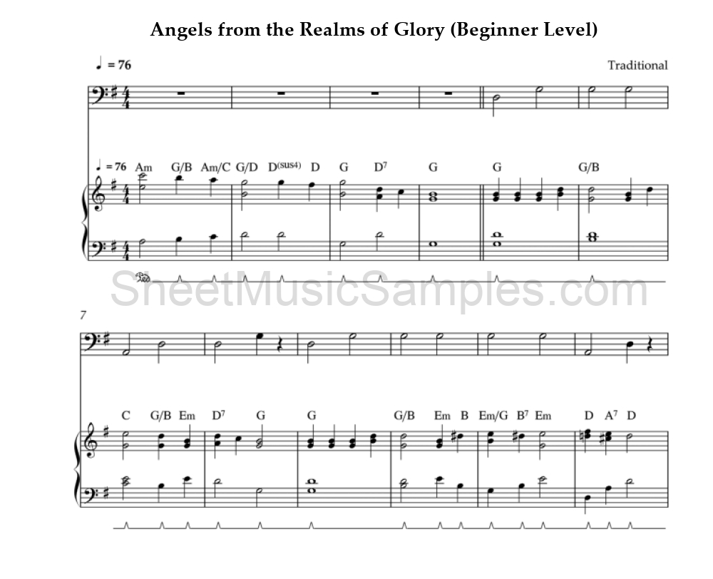 Angels from the Realms of Glory (Beginner Level)