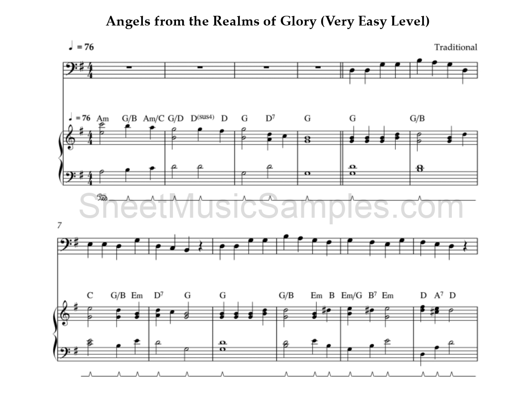 Angels from the Realms of Glory (Very Easy Level)